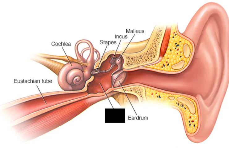 <p><span>Resides in a hollow chamber called the tympanic cavity. The cavity is lined with a mucous membrane. The cavity contains a canal called the Eustachian tube (pharyngotympanic tube) that connects with the nasopharynx. The tube is normally closed but opens with chewing, yawning, or swallowing. The tube opens briefly to equalize pressure between the tympanic cavity and the outside. Changes in pressure can disrupt the vibrations of the tympanic membrane and produce muffled sounds.</span></p>