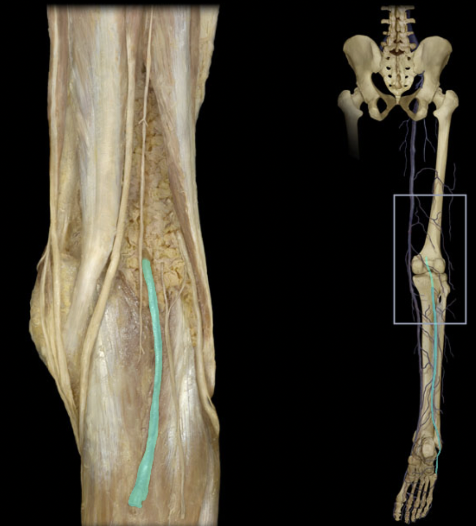 <p>Identify the blood vessel of the lower extremity</p>