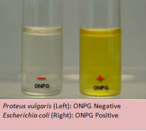 <ul><li><p>Detects beta-galactosidase, which is needed to break down lactose </p></li><li><p>Positive: liquid medium turns yellow</p></li></ul><p></p>