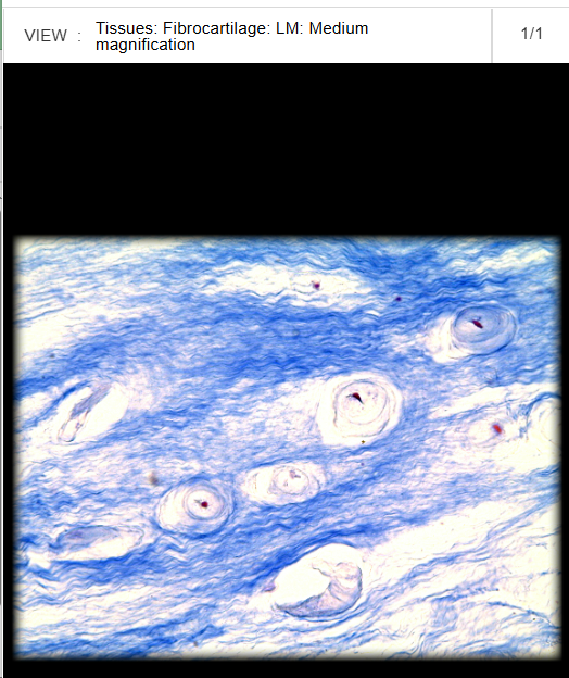 <p>Medial meniscus</p>