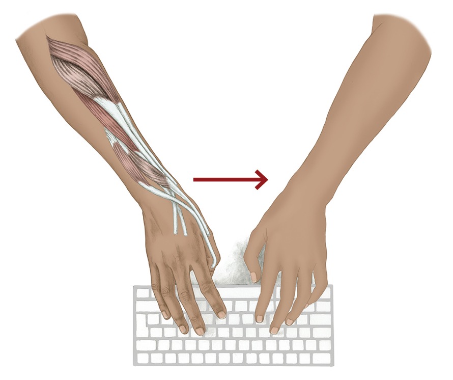 <p><span>extensor carpi radialis longus and brevis</span></p><p style="text-align: left;"><span>extensor pollicis longus and brevis</span></p><p style="text-align: left;"><span>flexor carpi radialis</span></p><p style="text-align: left;"><span>abductor pollicis longus&nbsp;</span></p>