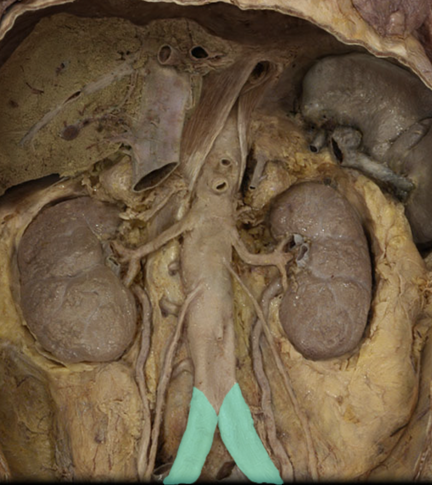 <p>Identify the feature of the abdominal aorta</p>