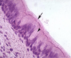<p>note the goblet cell</p>