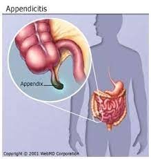 <p>appendix</p>