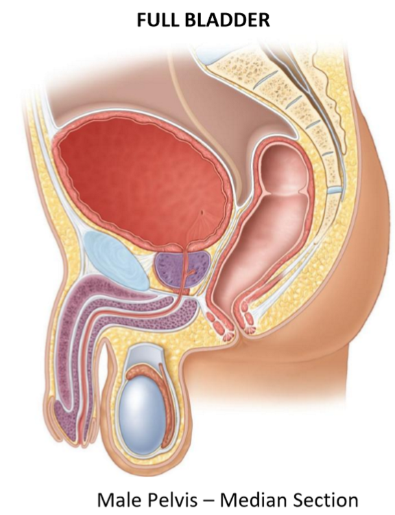 <ul><li><p>Expands <em>superiorly</em> into <strong>abdominal cavity</strong></p></li><li><p>Bladder <strong>neck</strong> remains relatively<strong> fixed</strong></p></li><li><p>Rugae <strong>flatten</strong> as wall stretches</p></li><li><p>Shape becomes more <strong>rounded/expanded</strong></p></li></ul><p></p>