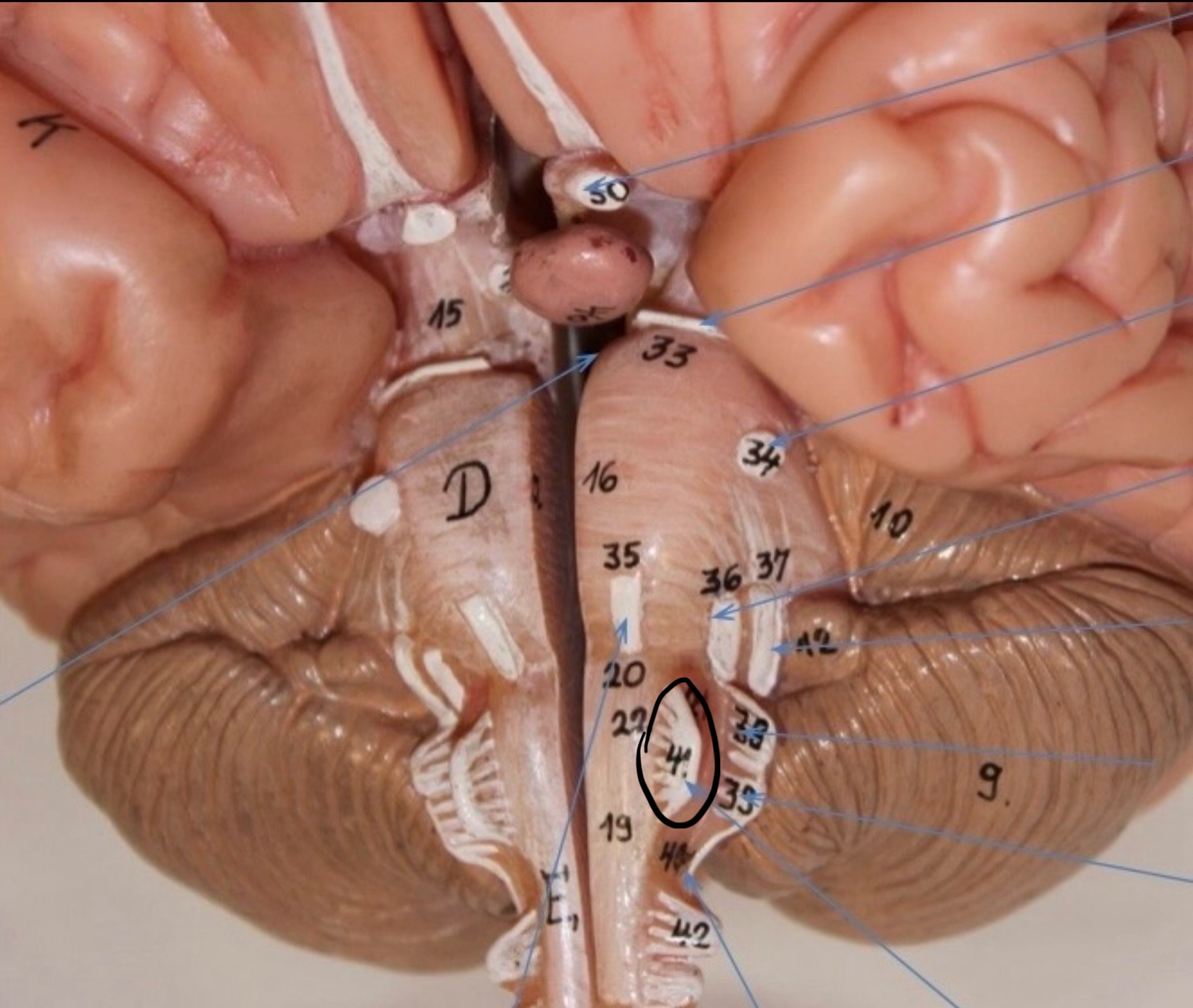 <p>Identify the circled area?</p>