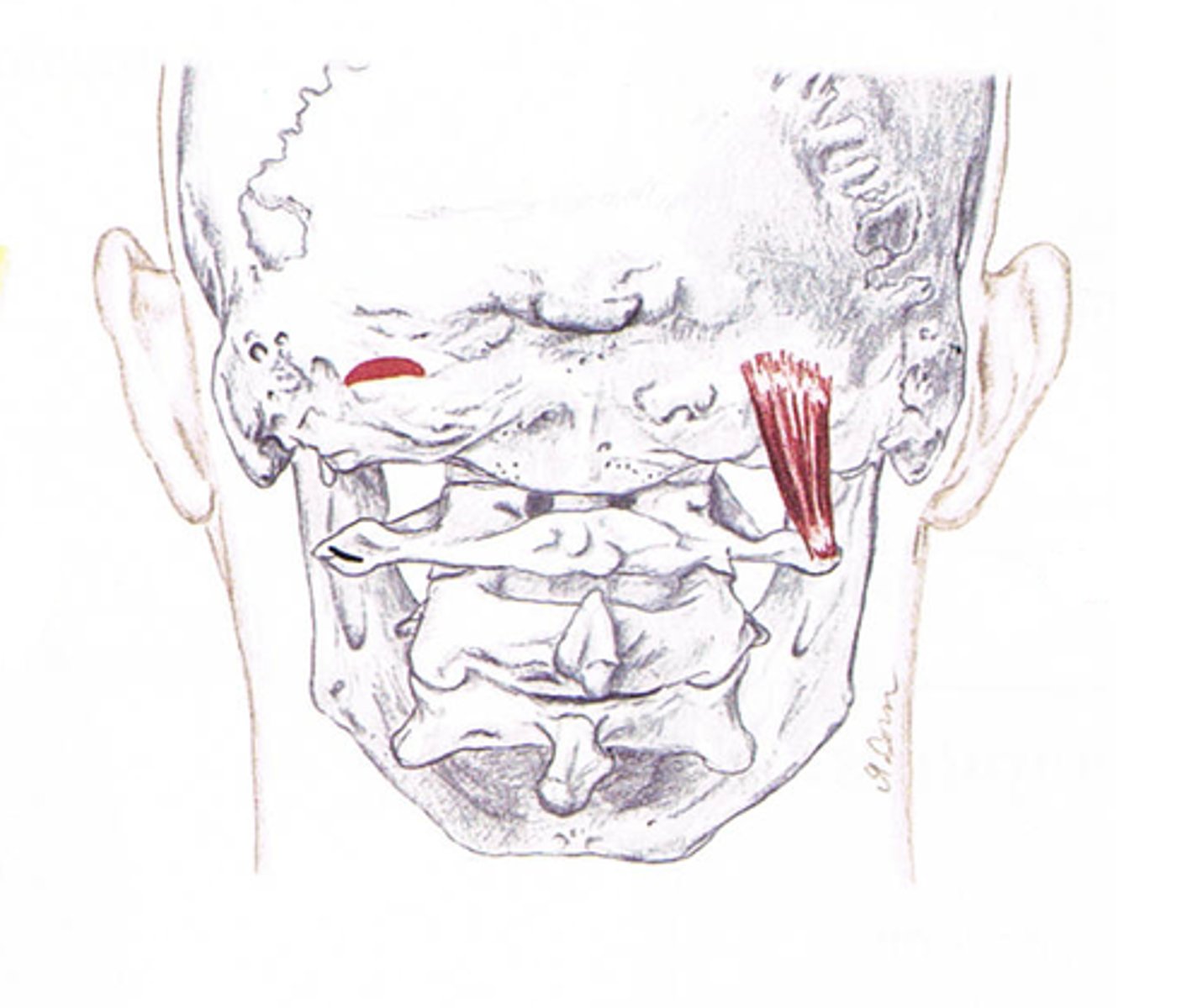<p>posterior ramus of C1</p>
