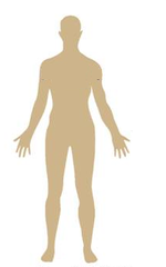 <p>A mutation that occurs in a body cell and is generally not passed to offspring.</p>
