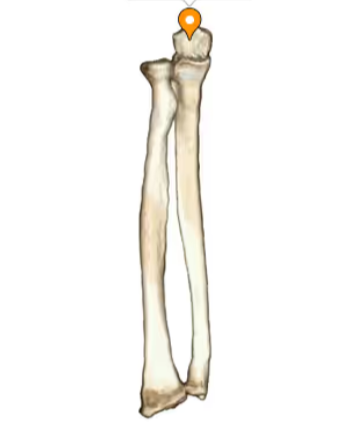 <p>What bone landmark is this within the <strong>Ulna</strong></p><ul><li><p>Medial Forarm Bone; Antebrachial, Ulnar Region)</p></li></ul><p></p>