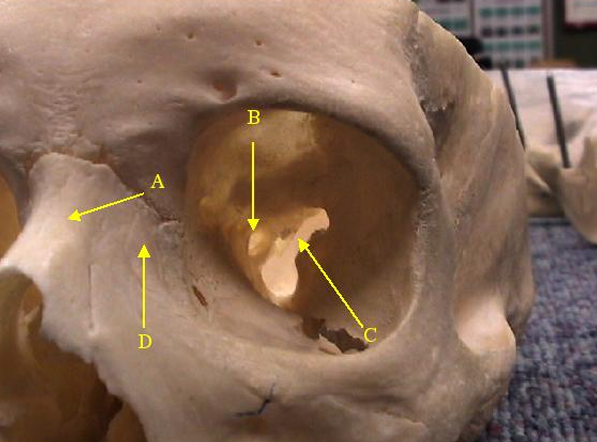 <p>Identify opening B.</p>
