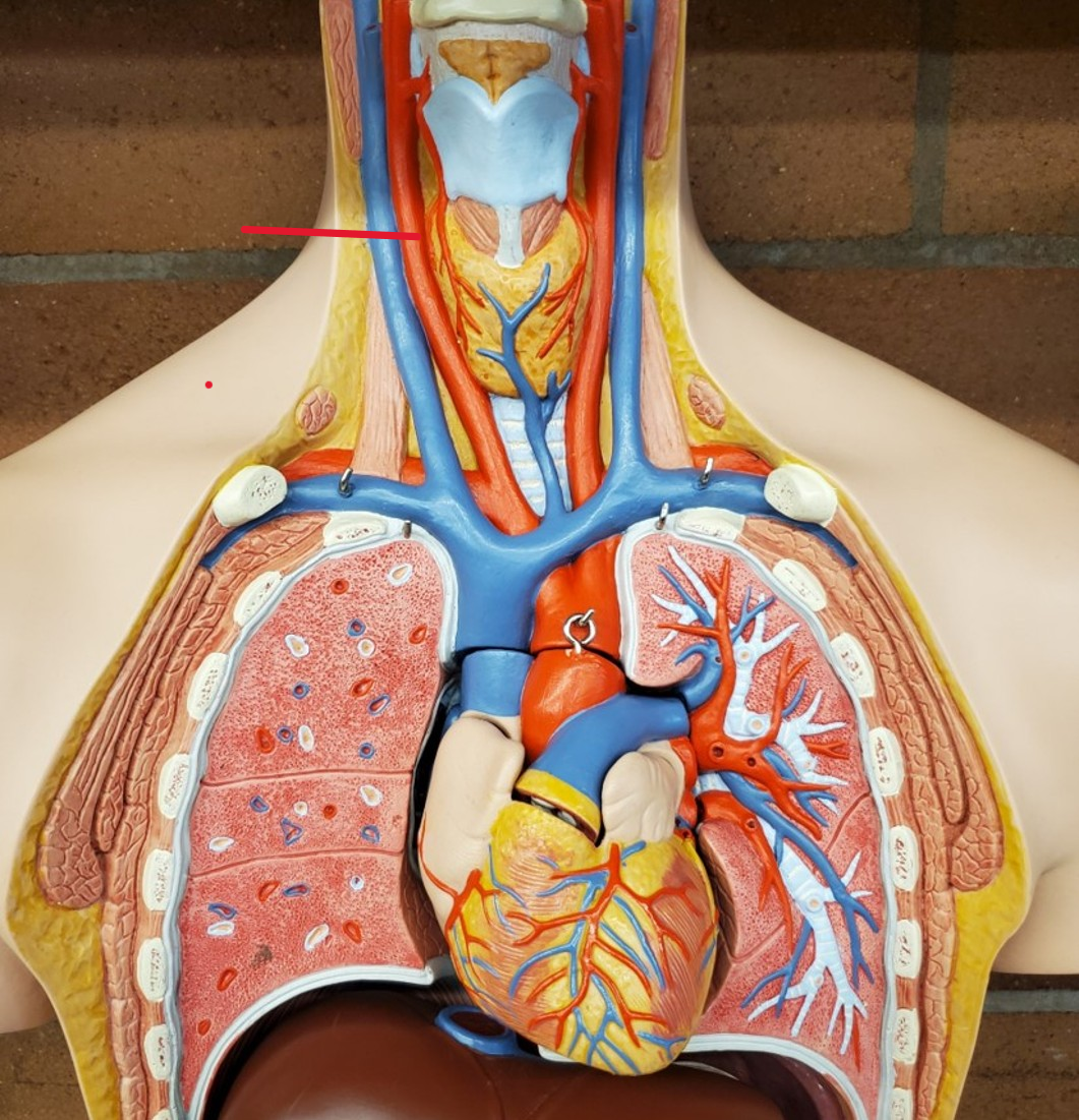 <p>Name the artery</p>