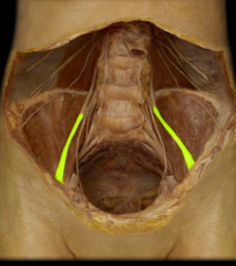 <p>identify the structure</p>