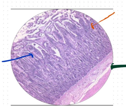 <p>What histology is this?What is the orange arrow? What is the blue arrow? What is the green arrow?</p>