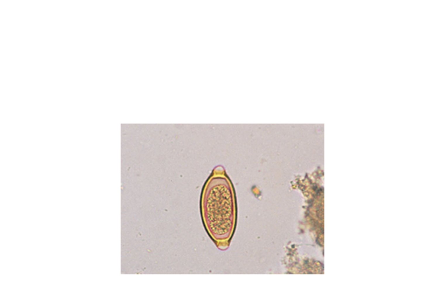 <p>ID which Nematode this egg belongs to:</p>