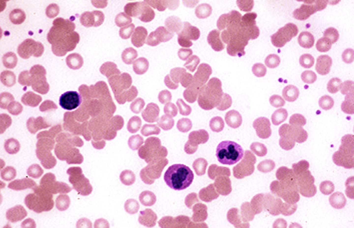 <p>Red blood cells clump together due to antibodies coating RBC surface</p>