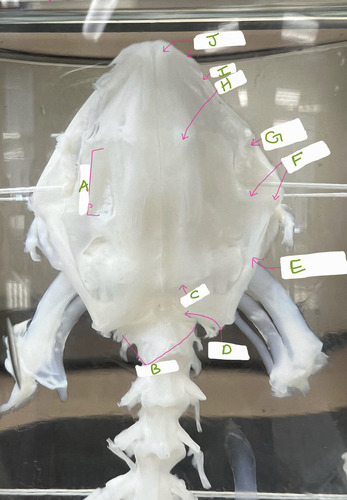 <p>B</p>