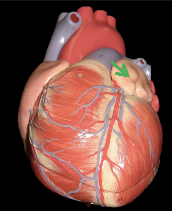 <p>Identify the structure </p>