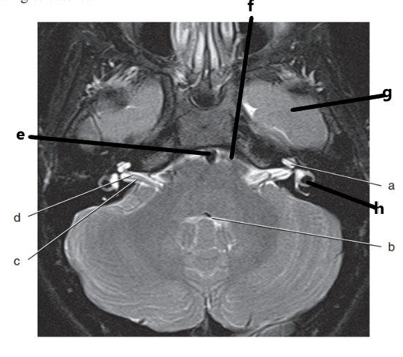 <p>c and d are inside what structure ?</p>
