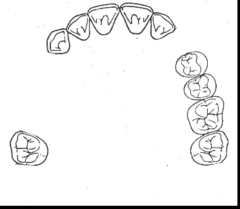 <p>What kennedy classification?</p>