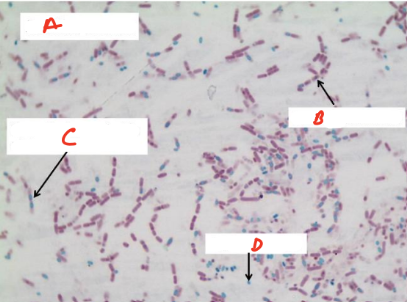 <p>Bacteria Species (A): </p><p>Endospore +/ - : </p><p>Name B,C,D: </p><p></p>