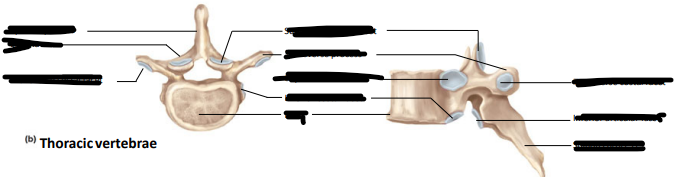 <p>Label the following:</p><ul><li><p>spinous process</p></li><li><p>lamina</p></li><li><p>transverse costal facet</p></li><li><p>body</p></li><li><p>superior articular facet</p></li><li><p>transverse process</p></li><li><p>superior costal facet</p></li><li><p>inferior costal facet</p></li><li><p>inferior articular facet</p></li></ul><p></p>