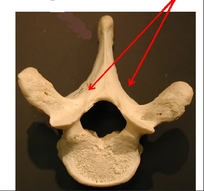 <p>What part of the vertebrae is this?</p>