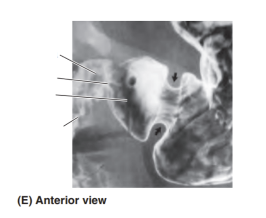 <p>Please label the anterior view of the stomach </p>