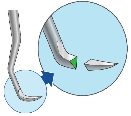 <ul><li><p>Triangualr</p></li><li><p>Pointed back</p></li><li><p>Pointed tip</p></li></ul><p></p><p>Use</p><ul><li><p>Primarily supragingival calculus</p></li></ul><p></p>