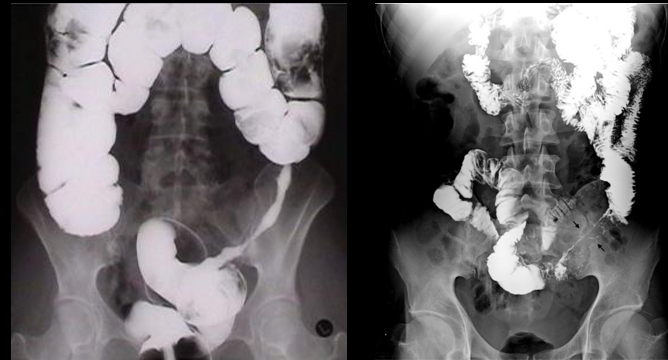 <p>pathology?</p>