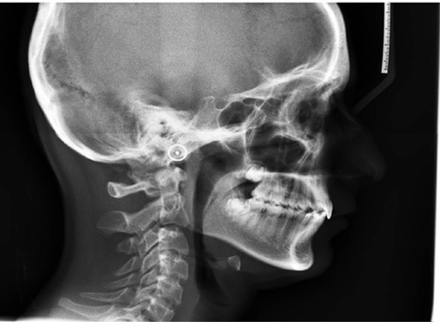 <p>- mainly used at the orthodontic offices so they can improve the patient's profile</p><p>- CEPH identifies the jaw relationship and growth patterns</p>