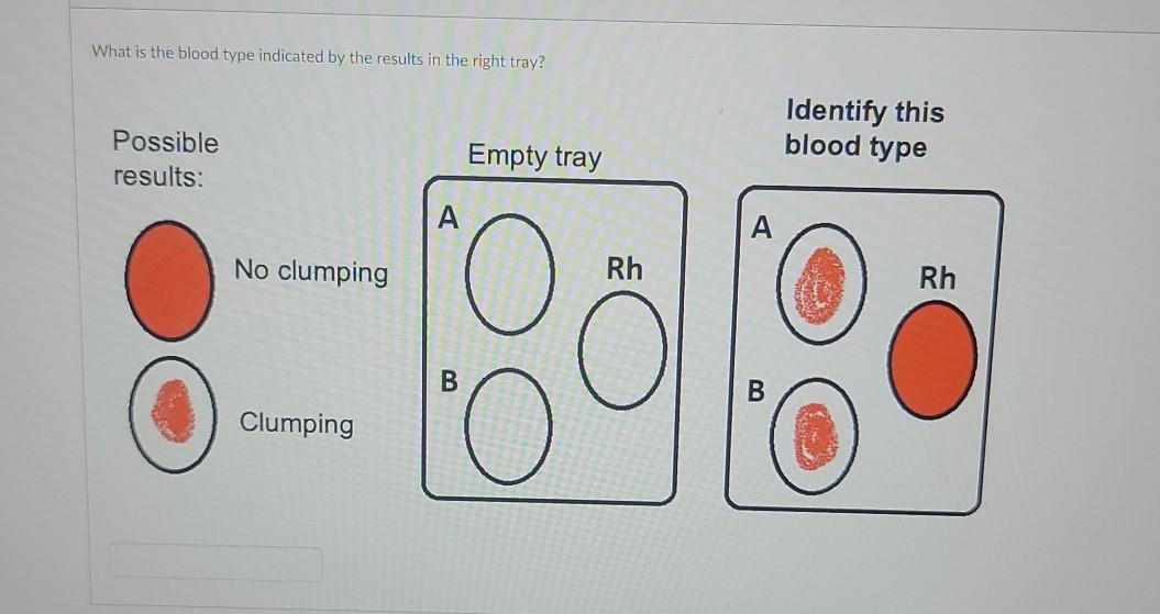 <p>What is the blood type indicated by the results in the right tray?</p>