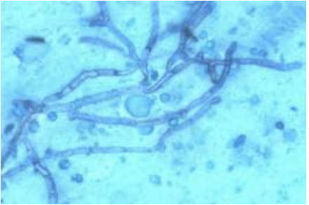 <p>what fungal agent is shown?</p>