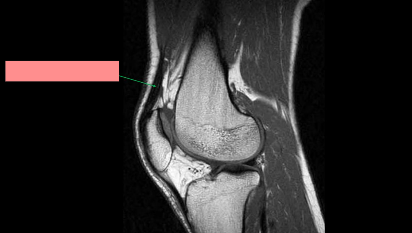 <p>Identify the structure</p>