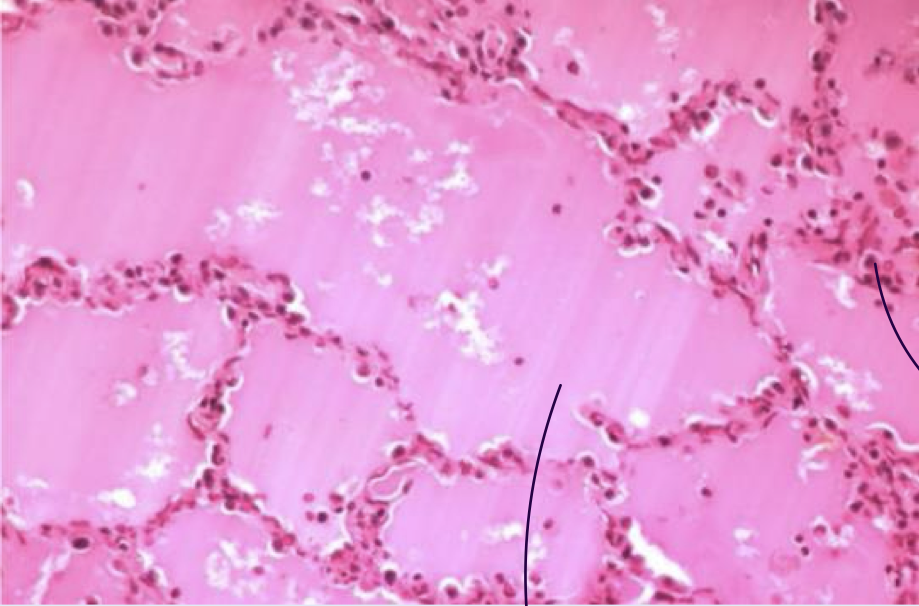 <p>Identify</p>