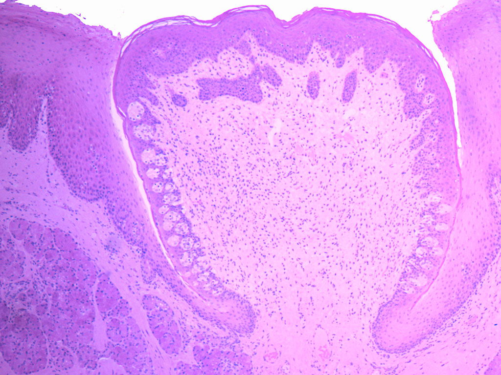 <p>Identify the papilla type:</p>