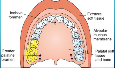 <p>pulps of: mx third molar, mx second molar, mx first molar (except for the MB root in some patients)</p><p>buccal bone and buccal periodontium over these teeth (NOT the palatal tissue)</p>