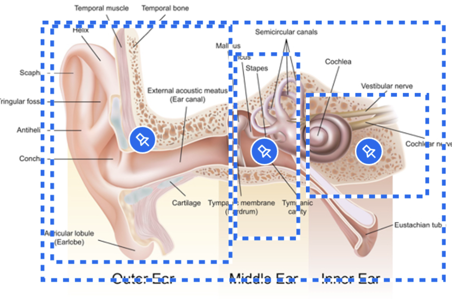 <p>Entire auditory system (outer, middle, inner ear)</p>