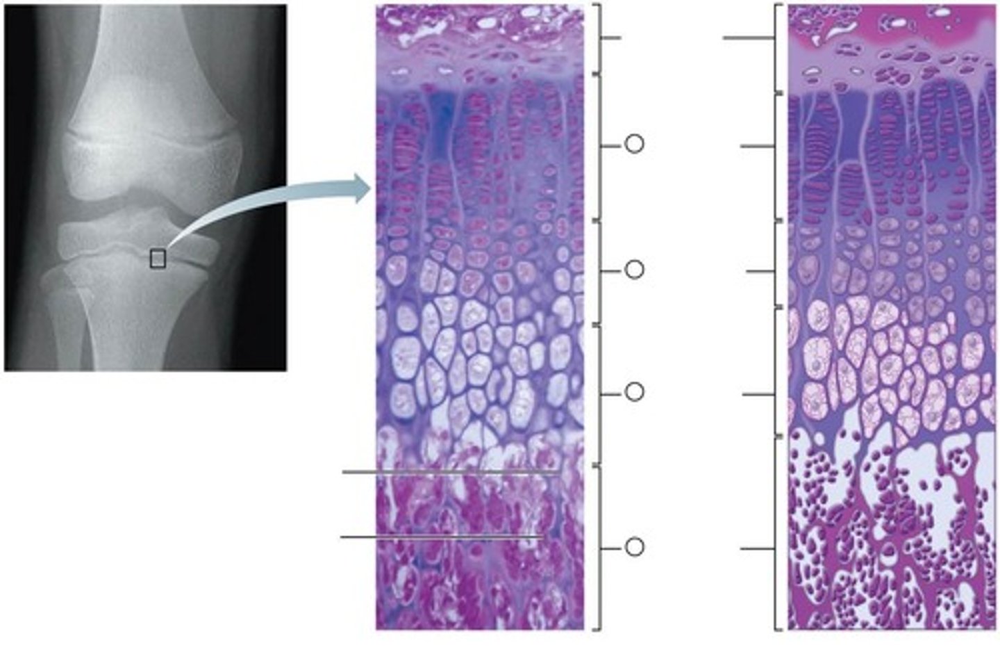 <p>Resting zone, proliferation zone, hypertrophic zone, calcification zone, ossification zone.</p>