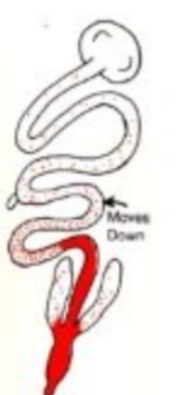 <p>What protozoan species affects avian rectum?</p>