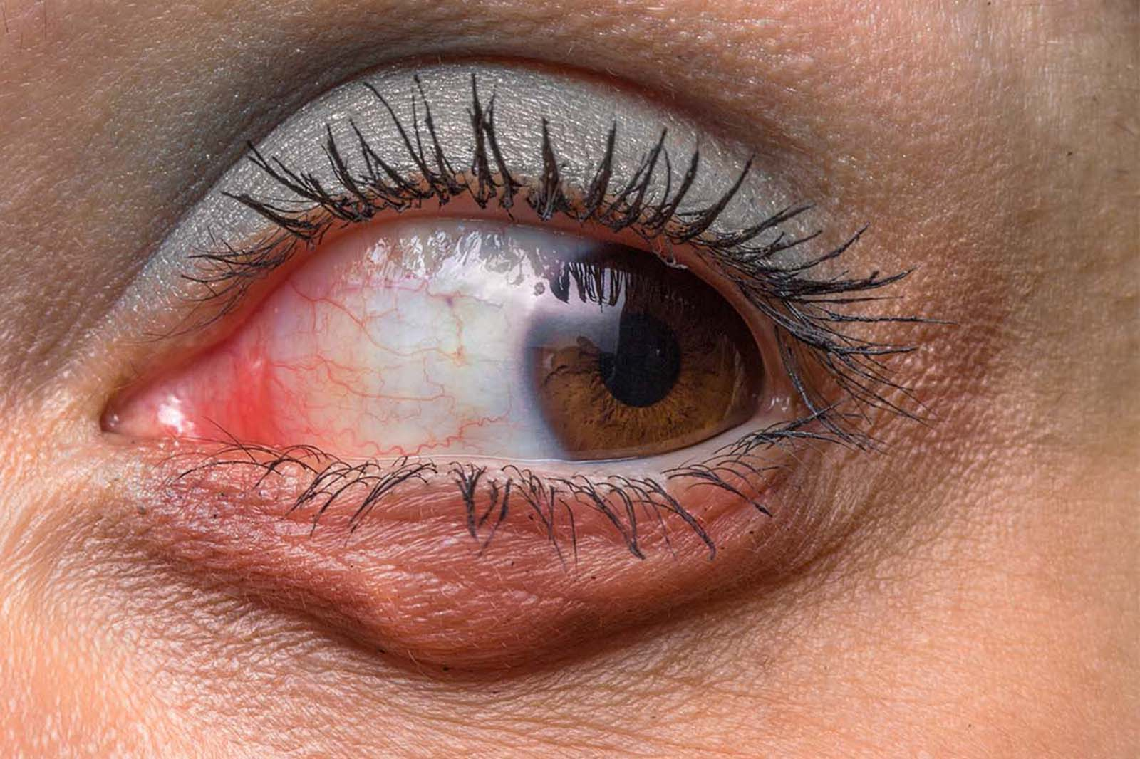 <p>¿De qué tejidos originan los Sarcomas palpebrales?</p>