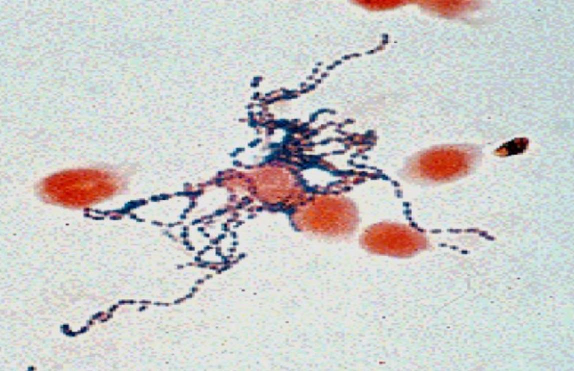 <p>Specimen (microscopically slide):</p><p>• Name of organism:</p><p>• Stain:</p><p>• Sample from: culture or pus or in tissue</p><p>• Morphology</p>