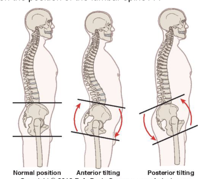 <p><strong>Anterior pelvic Tilt:</strong></p><ul><li><p>ASIS moved anterior and inferior </p></li><li><p><strong>Movements of APT: </strong></p><ul><li><p>hip flexion → ANT part of femur gets close to ASIS</p></li><li><p>lumbar extension</p></li></ul></li></ul><p></p><p><strong>Posterior pelvic Tilt:</strong></p><ul><li><p>ASIS moved posterior and superior</p></li><li><p><strong>Movements of APT: </strong></p><ul><li><p>hip extension → ischial tuberosity gets closer to POST part of femur</p></li><li><p>lumbar flexion</p></li></ul></li></ul><p></p>