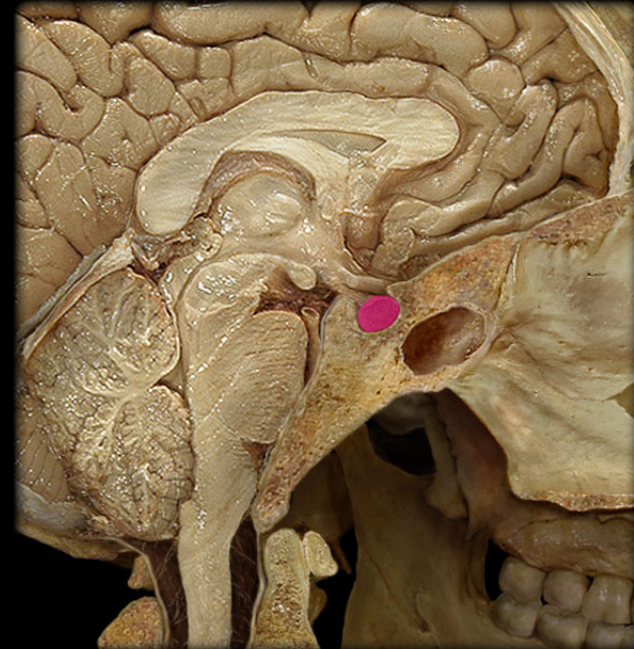 term image