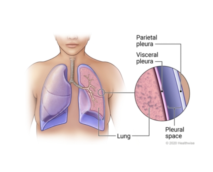 <p>covers the inside of the lungs</p>