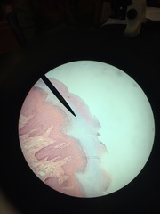 <p>Thin translucent zone</p><p>FINGERTIPS, PALMS, AND SOLES (THICK SKIN)</p><p>Filled with eleiden (precursor to keratin)</p>