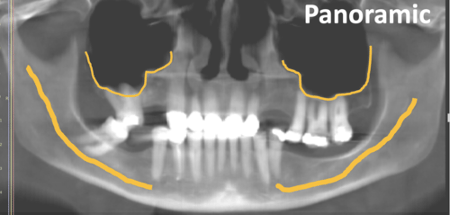<p>What is the lower yellow line indicating?</p>
