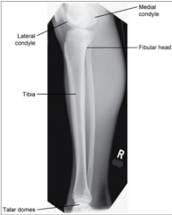 <p>- entire tibia and fibula superimposed</p><p>- both knee and ankle joints included</p>