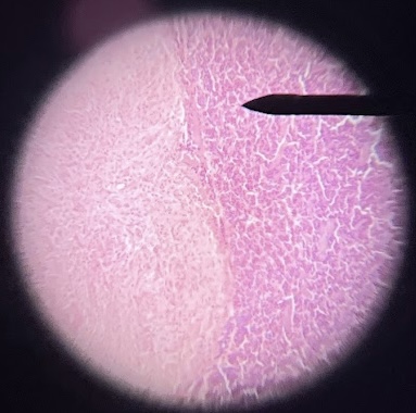 <p>The structure with the pointer depicts which part of the pituitary gland.</p>