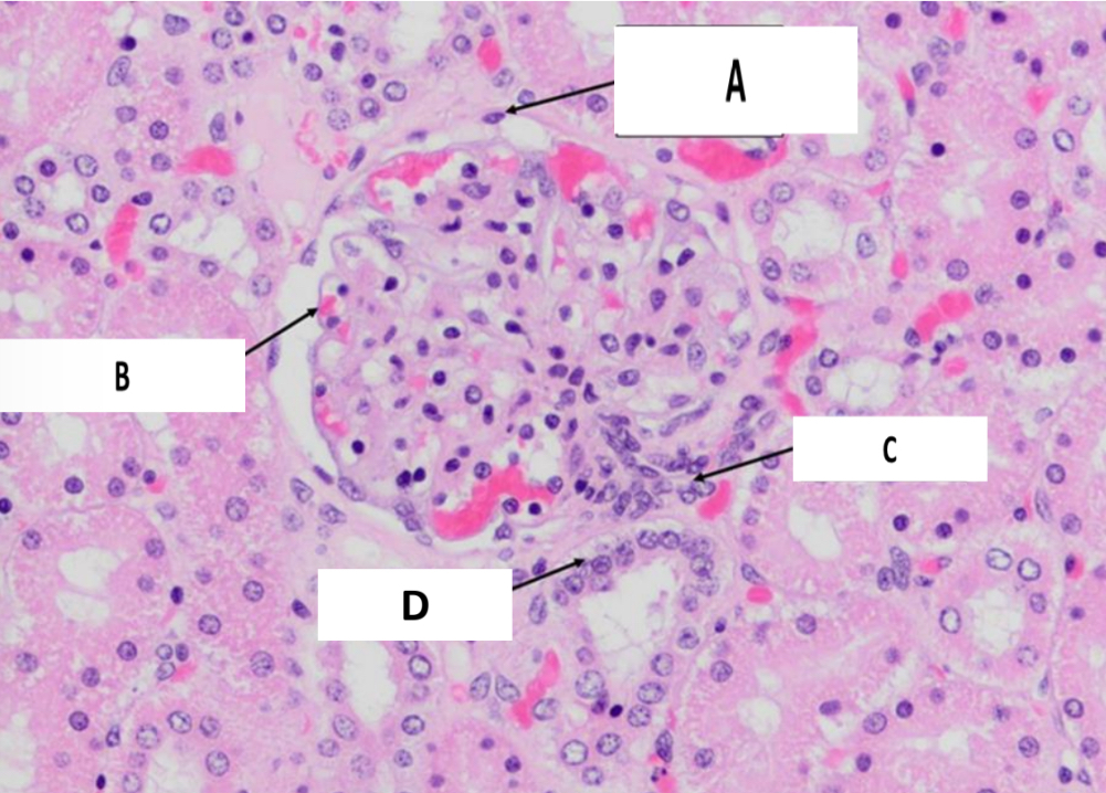 <p>Name the structure indicated by B.</p>