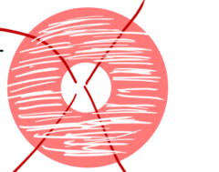 <p>What does diffuse neuro retinal rim pallor indicate?</p>